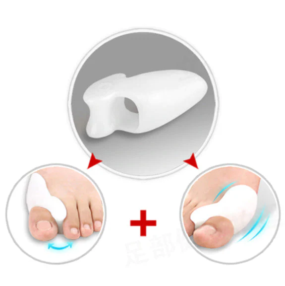 Zehentrenner-Set zur Korrektur von Hallux Valgus | 2 Stücke - Image 6